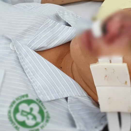 phòng tránh vi khuẩn ăn mòn cơ thể Whitmore