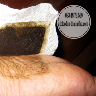 Miếng dán thải độc Thái Lan