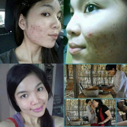 thanakha, thanaka, bột thanakha